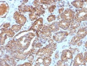 IHC staining of FFPE human prostate tissue with Cyclooxygenase 2 antibody (clone COX2/7803R). HIER: boil tissue sections in pH 9 10mM Tris with 1mM EDTA for 20 min and allow to cool before testing.