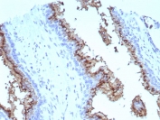 IHC staining of FFPE human prostate tissue with Prostein antibody (clone SLC45A3/7647). HIER: boil tissue sections in pH 9 10mM Tris with 1mM EDTA for 20 min and allow to cool before testing.