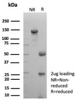 SDS-PAGE analysis of purified, BSA-free Prostein antibody (clone SLC45A3/7650) as confirmation of integrity and purity.