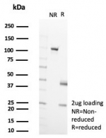 SDS-PAGE analysis of purified, BSA-free CD35 antibody (clone rCR1/8596) as confirmation of integrity and purity.