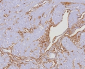 IHC staining of FFPE human uterus tissue with CD34 antibody (clone HPCA1/4393R). HIER: boil tissue sections in pH 9 10mM Tris with 1mM EDTA for 20 min and allow to cool before testing.