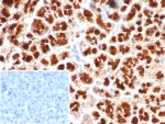 IHC staining of FFPE human pancreas tissue with GIRK2 antibody (clone KCNJ6/7558) at 2ug/ml. Inset: PBS used in place of primary Ab (secondary Ab negative control). HIER: boil tissue sections in pH 9 10mM Tris with 1mM EDTA for 20 min and allow to cool before testing.