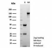 SDS-PAGE analysis of purified, BSA-free FABP1 antibody (clone FABP1/4519) as confirmation of integrity and purity.