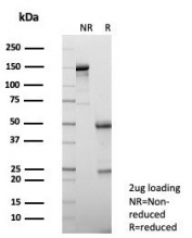 SDS-PAGE analysis of purified, BSA-free FABP1 antibody (clone FABP1/4990) as confirmation of integrity and purity.
