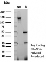SDS-PAGE analysis of purified, BSA-free FABP3 antibody (clone FABP3/8443) as confirmation of integrity and purity.
