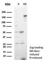 SDS-PAGE analysis of purified, BSA-free FABP3 antibody (clone rFABP3/8534) as confirmation of integrity and purity.