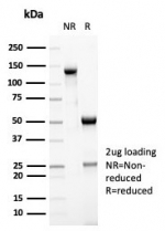 SDS-PAGE analysis of purified, BSA-free MSH6 antibody (clone MSH6/7064R) as confirmation of integrity and purity.