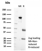 SDS-PAGE analysis of purified, BSA-free Langerin antibody (clone LGRN/7356) as confirmation of integrity and purity.