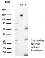 SDS-PAGE analysis of purified, BSA-free Langerin antibody (clone LGRN/7428) as confirmation of integrity and purity.