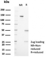 SDS-PAGE analysis of purified, BSA-free IL18R1 antibody (clone IL18R1/7591) as confirmation of integrity and purity.