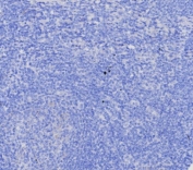 Negative control: IHC testing of FFPE human tonsil tissue with EGP40 antibody (clone EGP40/8130R) at 2ug/ml. HIER: boil tissue sections in pH 9 10mM Tris with 1mM EDTA for 20 min and allow to cool before testing.