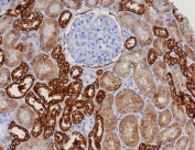 IHC testing of FFPE human kidney tissue with EGP40 antibody (clone EGP40/8130R). HIER: boil tissue sections in pH 9 10mM Tris with 1mM EDTA for 20 min and allow to cool before testing.