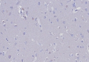 Negative control: IHC testing of FFPE human tonsil tissue with EGP40 antibody (clone EGP40/8191R) at 2ug/ml. HIER: boil tissue sections in pH 9 10mM Tris with 1mM EDTA for 20 min and allow to cool before testing.