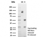 SDS-PAGE analysis of purified, BSA-free BSEP antibody (clone BSEP/7534) as confirmation of integrity and purity.