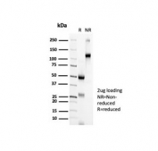 SDS-PAGE analysis of purified, BSA-free CTLA4 antibody (clone CTLA4/6864R) as confirmation of integrity and purity.