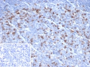 IHC staining of FFPE human tonsil tissue with CTLA4 antibody (clone CTLA4/6864R). Inset: PBS used in place of primary Ab (secondary Ab negative control). HIER: boil tissue sections in pH 9 10mM Tris with 1mM EDTA for 20 min and allow to cool before testing.