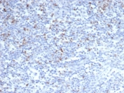 IHC staining of FFPE human tonsil tissue with CTLA4 antibody (clone CTLA4/6864R). HIER: boil tissue sections in pH 9 10mM Tris with 1mM EDTA for 20 min and allow to cool before testing.