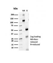 SDS-PAGE analysis of purified, BSA-free Cytotoxic T-lymphocyte protein 4 antibody (clone CTLA4/6867R) as confirmation of integrity and purity.