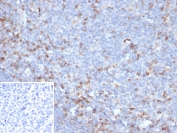 IHC staining of FFPE human tonsil tissue with Cytotoxic T-lymphocyte protein 4 antibody (clone CTLA4/6867R). Inset: PBS used in place of primary Ab (secondary Ab negative control). HIER: boil tissue sections in pH 9 10mM Tris with 1mM EDTA for 20 min and allow to cool before testing.