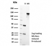 SDS-PAGE analysis of purified, BSA-free Nucleolin antibody (clone NCL/7339) as confirmation of integrity and purity.