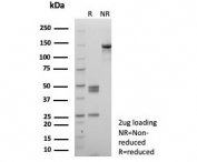 SDS-PAGE analysis of purified, BSA-free recombinant SATB2 antibody (clone rSATB2/8634) as confirmation of integrity and purity.
