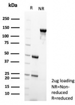 SDS-PAGE analysis of purified, BSA-free IDH1-R132H Mutant antibody (clone IDH1.R132H/8205R).