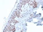 IHC staining of FFPE human skin tissue with XRCC5 / Ku86 / Ku80 antibody (clone XRCC5/7316). HIER: boil tissue sections in pH 9 10mM Tris with 1mM EDTA for 20 min and allow to cool before testing.