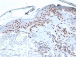 IHC staining of FFPE human skin tissue with XRCC5 / Ku86 / Ku80 antibody (clone XRCC5/7314). Inset: PBS used in place of primary Ab (secondary Ab negative control). HIER: boil tissue sections in pH 9 10mM Tris with 1mM EDTA for 20 min and allow to cool before testing.