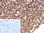 IHC staining of FFPE human tonsil tissue with Ku80 antibody (clone XRCC5/8703R). Inset: PBS used in place of primary Ab (secondary Ab negative control). HIER: boil tissue sections in pH 9 10mM Tris with 1mM EDTA for 20 min and allow to cool before testing.