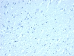 Negative control: IHC testing of FFPE human brain tissue with INHA antibody (clone INHA/8872R) at 2ug/ml. HIER: boil tissue sections in pH 9 10mM Tris with 1mM EDTA for 20 min and allow to cool before testing.