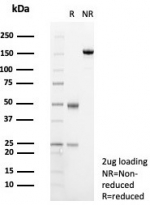 SDS-PAGE analysis of purified, BSA-free Transferrin antibody (clone TF/4797) as confirmation of integrity and purity.