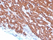 IHC staining of FFPE human liver tissue with Transferrin antibody (clone TF/4797). HIER: boil tissue sections in pH 9 10mM Tris with 1mM EDTA for 20 min and allow to cool before testing.
