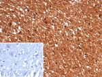 IHC staining of FFPE human brain tissue with GBX2 antibody (clone GBX2/7235). Inset: PBS used in place of primary Ab (secondary Ab negative control). HIER: boil tissue sections in pH 9 10mM Tris with 1mM EDTA for 20 min and allow to cool before testing.