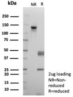 SDS-PAGE analysis of purified, BSA-free MLH1 antibody (clone rMLH1/8630) as confirmation of integrity and purity.