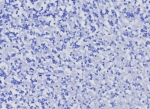 Negative control: IHC testing of FFPE human brain tissue with CD10 antibody (clone MME/8376R) at 2ug/ml. HIER: boil tissue sections in pH 9 10mM Tris with 1mM EDTA for 20 min and allow to cool before testing.