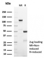 SDS-PAGE analysis of purified, BSA-free Forkhead box protein L2 antibody (clone FOXL2/8362R) as confirmation of integrity and purity.