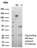 SDS-PAGE analysis of purified, BSA-free p40 antibody (clone P40/8225R) as confirmation of integrity and purity.