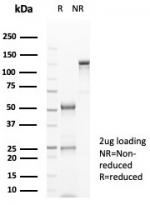 SDS-PAGE analysis of purified, BSA-free CD38 antibody (clone CD38/8075R) as confirmation of integrity and purity.