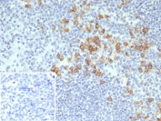 IHC staining of FFPE human tonsil tissue with CD38 antibody (clone CD38/8075R). Inset: PBS used in place of primary Ab (secondary Ab negative control). HIER: boil tissue sections in pH 9 10mM Tris with 1mM EDTA for 20 min and allow to cool before testing.