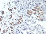 IHC staining of FFPE human adrenal gland tissue with IL-2 antibody (clone IL2/4984). HIER: boil tissue sections in pH 9 10mM Tris with 1mM EDTA for 20 min and allow to cool before testing.