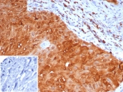 IHC staining of FFPE human placental tissue with S100P antibody (clone S100P/7373). Inset: PBS used in place of primary Ab (secondary Ab negative control). HIER: boil tissue sections in pH 9 10mM Tris with 1mM EDTA for 20 min and allow to cool before testing.