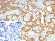 IHC staining of FFPE human placenta with S100P antibody (clone S100P/7373). Inset: PBS used in place of primary Ab (secondary Ab negative control). HIER: boil tissue sections in pH 9 10mM Tris with 1mM EDTA for 20 min and allow to cool before testing.