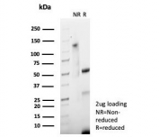 SDS-PAGE analysis of purified, BSA-free S100P antibody (clone S100P/7978R) as confirmation of integrity and purity.