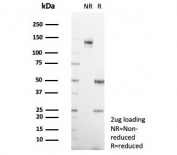 SDS-PAGE analysis of purified, BSA-free Interleukin-2 antibody (clone IL2/4987) as confirmation of integrity and purity.