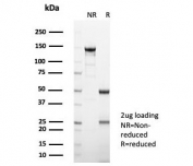 SDS-PAGE analysis of purified, BSA-free Interleukin-2 antibody (clone IL2/4988) as confirmation of integrity and purity.