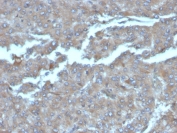 IHC staining of FFPE human adrenal gland tissue with Interleukin-2 antibody (clone IL2/4983). HIER: boil tissue sections in pH 9 10mM Tris with 1mM EDTA for 20 min and allow to cool before testing.