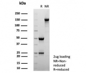 SDS-PAGE analysis of purified, BSA-free Interleukin-2 antibody (clone IL2/4983) as confirmation of integrity and purity.