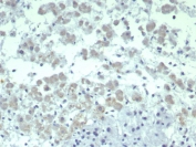 IHC staining of FFPE human adrenal gland tissue with Interleukin-2 antibody (clone IL2/4986). HIER: boil tissue sections in pH 9 10mM Tris with 1mM EDTA for 20 min and allow to cool before testing.
