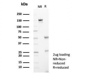 SDS-PAGE analysis of purified, BSA-free Interleukin-2 antibody (clone IL2/4986) as confirmation of integrity and purity.