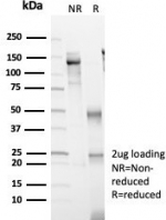 SDS-PAGE analysis of purified, BSA-free p504S antibody (clone AMACR/4757) as confirmation of integrity and purity.